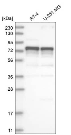 ILF1 Antibody, Novus Biologicals 25 &mu;L; Unlabeled:Antibodies, Polyclonal